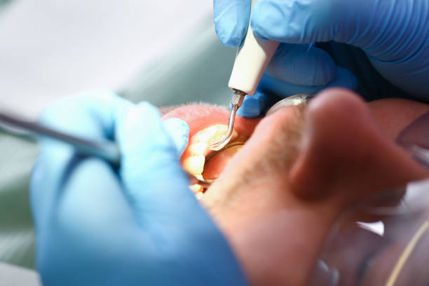 Best Broken or Cracked Tooth Emergency Dentist in Weatherly, PA